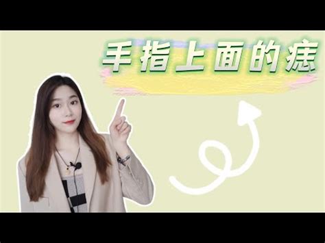 左手中指有痣|女生左手中指有痣是什么意思？女性痣相的寓意